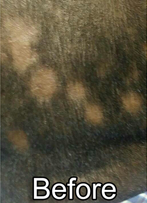 Before-Alopecia-Areata
