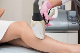 laser hair removal in indore