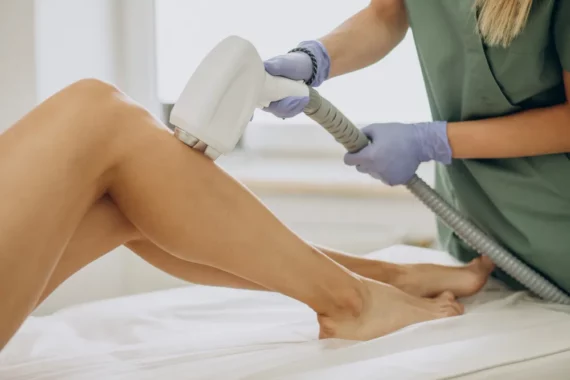 laser hair removal in indore, laser hair removal treatment in indore